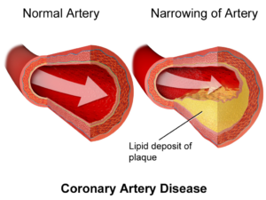 cholesterol.png